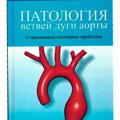 Паталогіі галін дугі аорты: сучасны стан праблемы