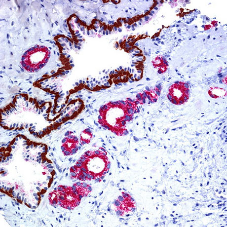 Імунагістахімічныя даследаванні тканак