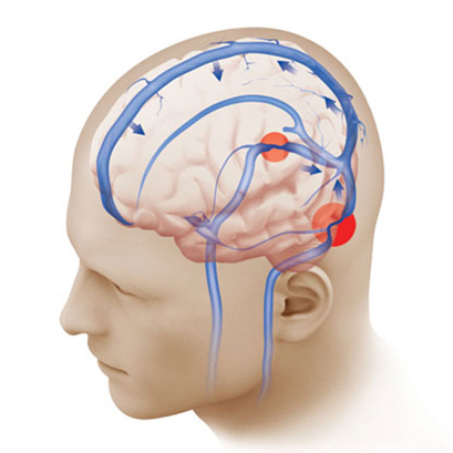 Лячэнне і рэабілітацыя захворванняў нервовай сістэмы