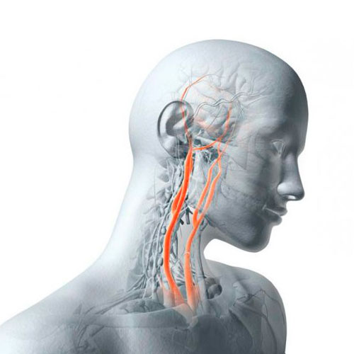 Сасудзістая хірургія