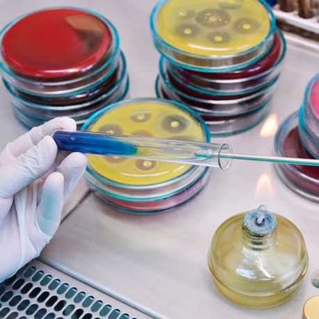 Бактэрыялагічныя даследванні