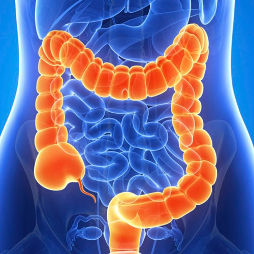 Аператыўныя умяшанні на кішэчніку