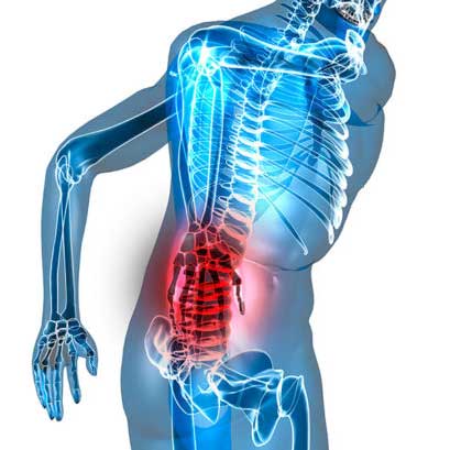 Лячэнне болей у спіне