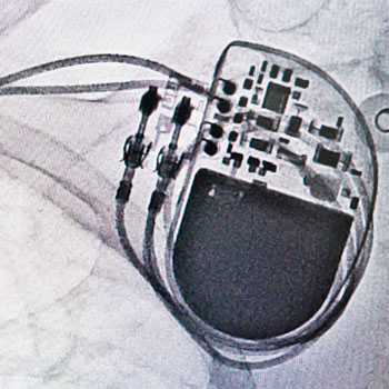 Рентгенооперационная