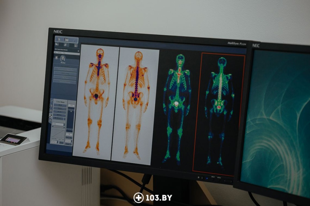 osteo1.jpg