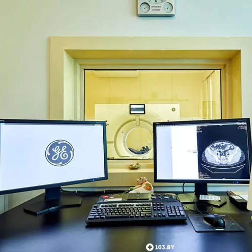 Рэнтгенаўская камп'ютарная тамаграфія (КТ) 