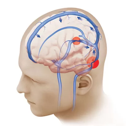 Лячэнне і рэабілітацыя захворванняў нервовай сістэмы