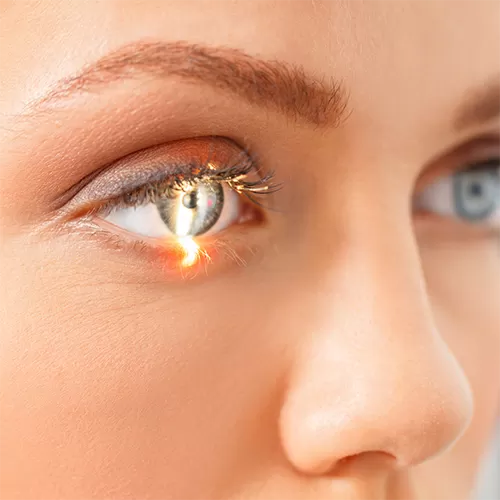 «Інавацыйная афтальмалогія»