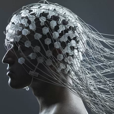 Электраэнцэфалаграфія