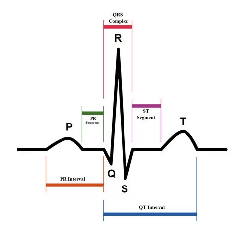Хірургічнае лячэнне мігальнай арытміі метадам крыяаблацыі
