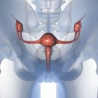 Хірургічнае лячэнне апушчэння і выпадзення палавых органаў
